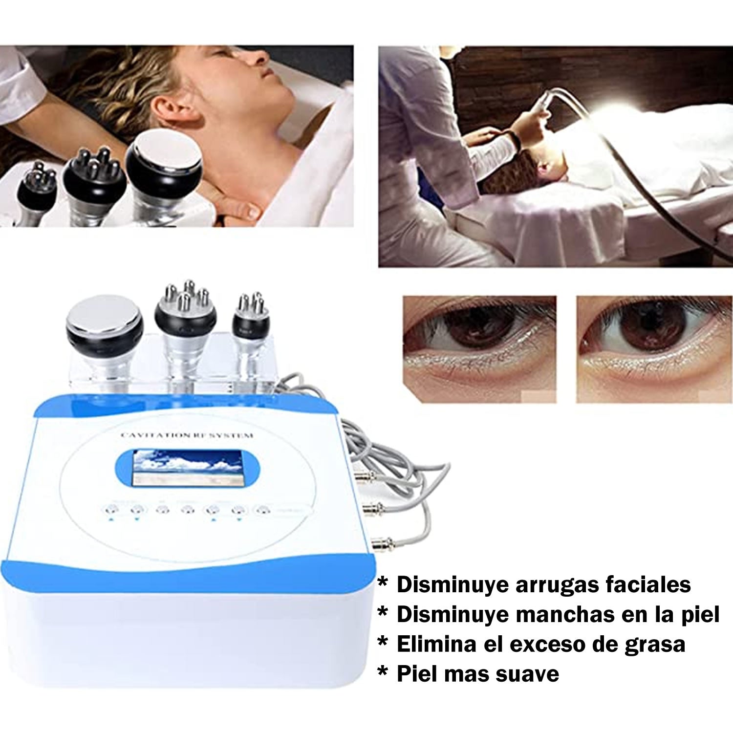 Maquina Cavitación corporal y radiofrecuencia facial