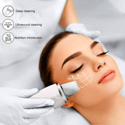 Peeling Ultrasónico 3 En 1  2w