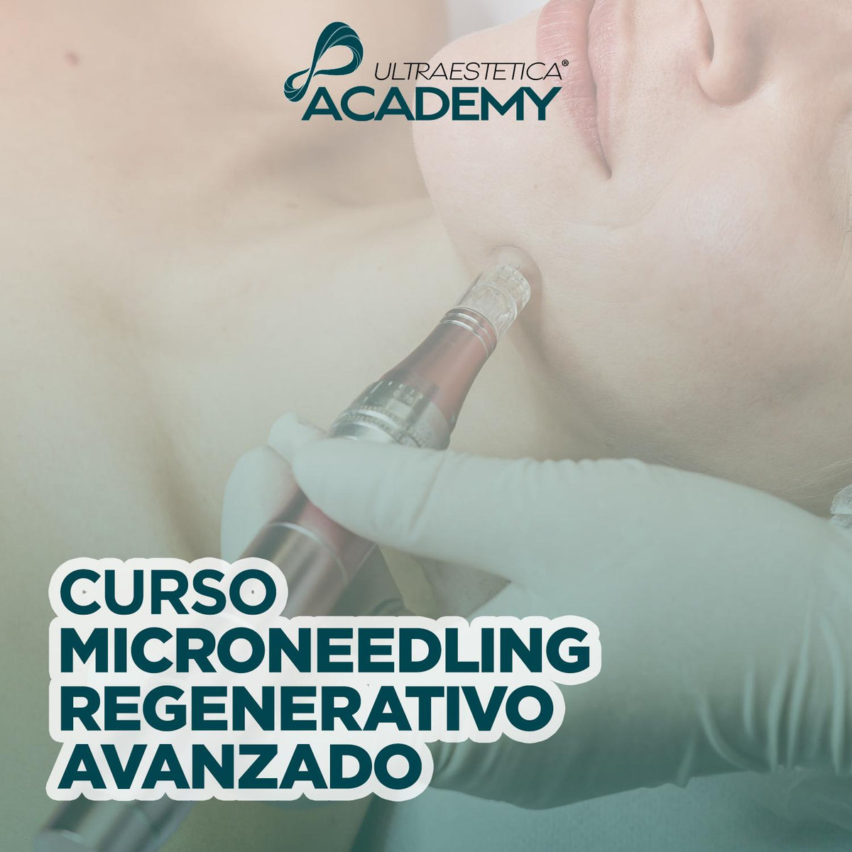 Curso Profesional de Microneedling (Dermapen) | Presencial