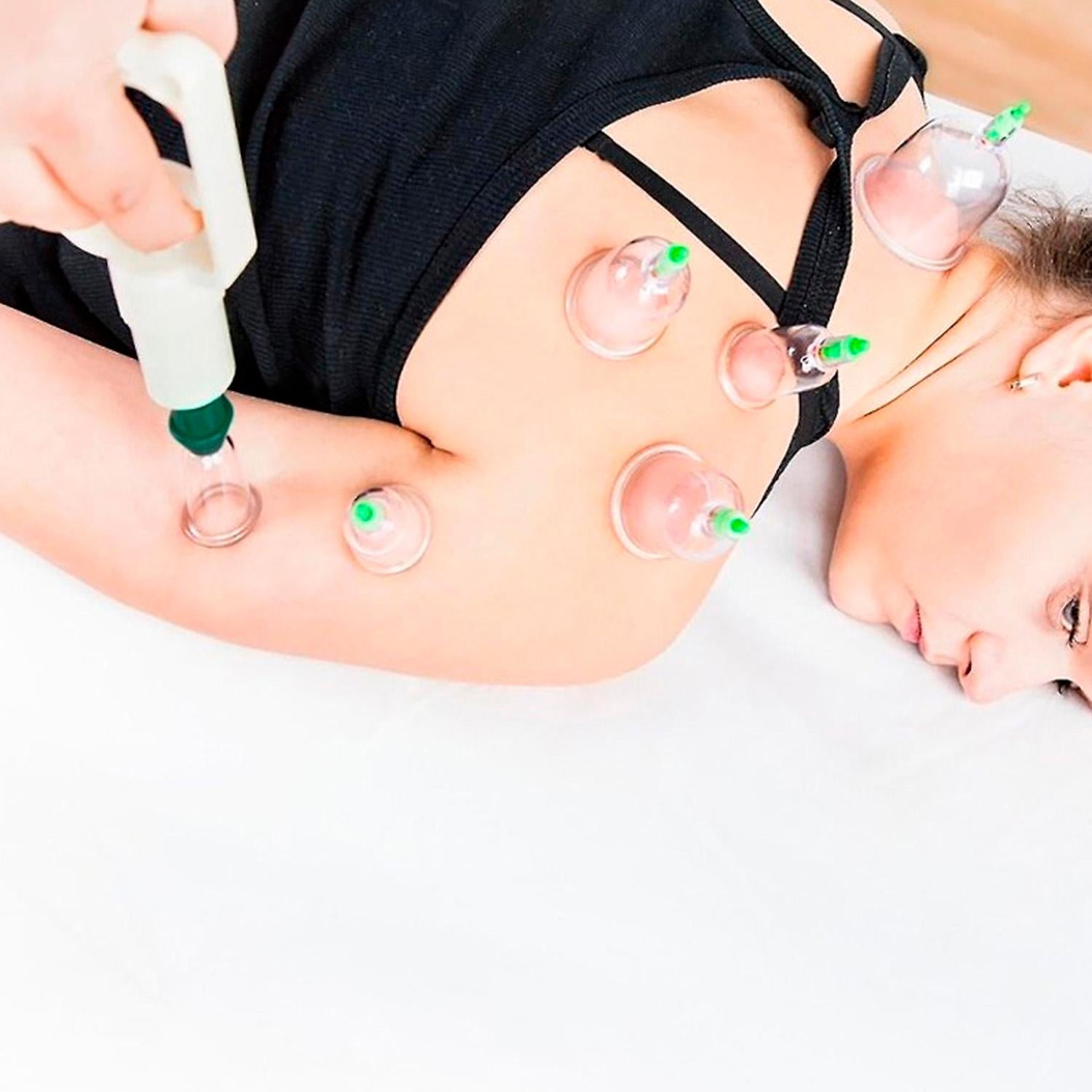 Set De Ventosas Para Masajes Ultra Estética - Main Image